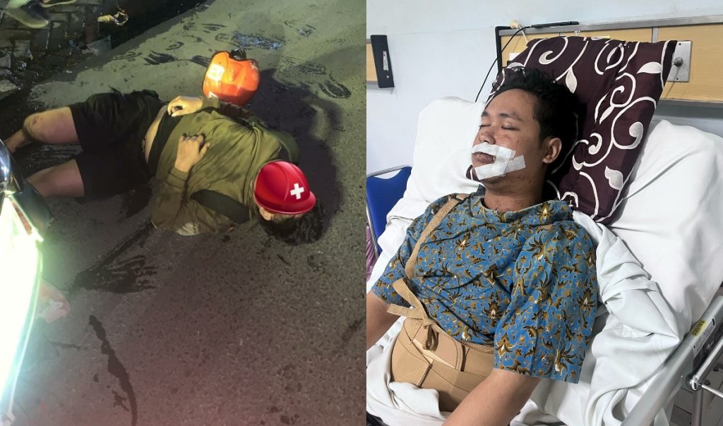 4 Update Kasus Laka Thoif Rico, Ada Info Penetapan Tersangka, Nomor 4 Parah Kacau Banget Lur