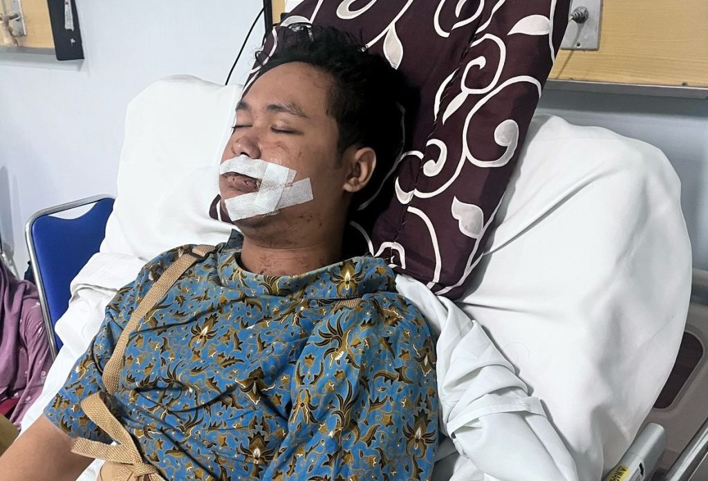 Kasus Kecelakaan Thoif Riko, Polrestabes Semarang Cari Jalan Keluar dengan Cara Ini